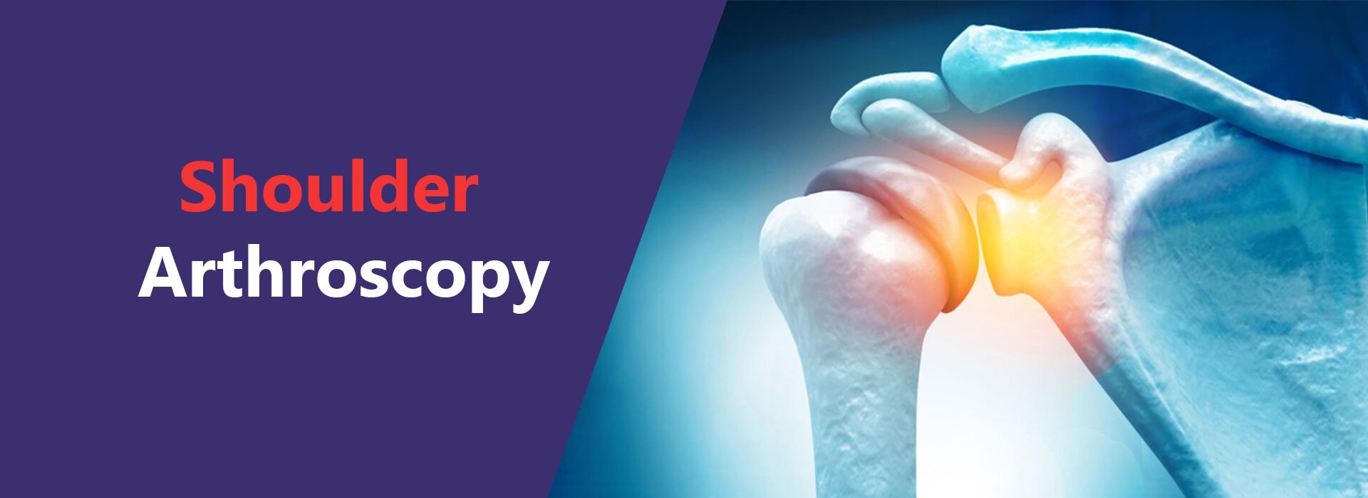 shoulder arthroscopy surgeon in Delhi