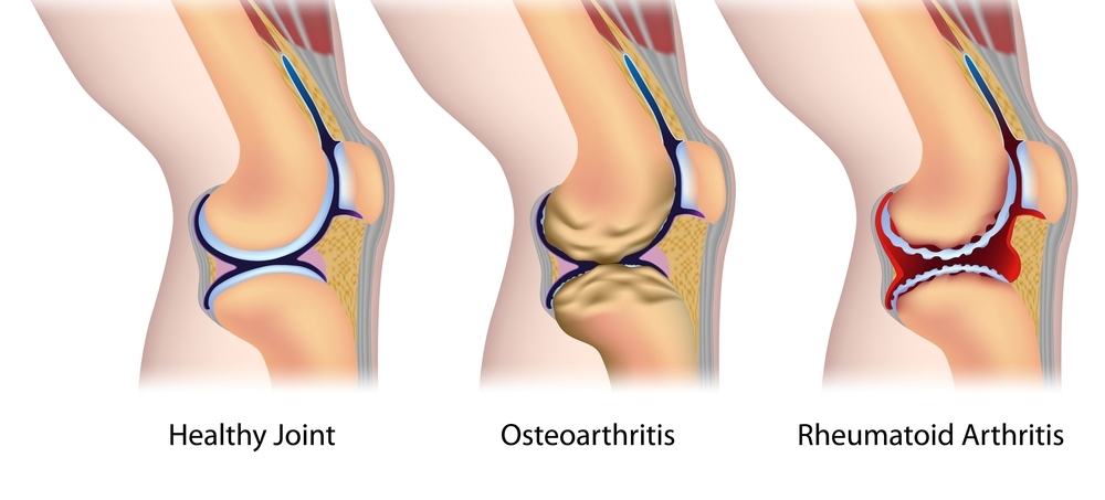 best knee arthroscopy surgeon in Delhi NCR